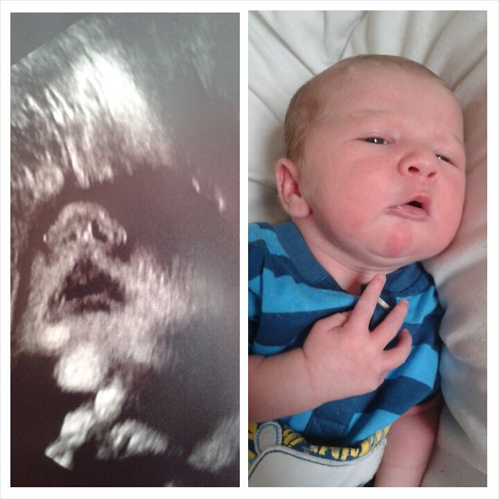 How much did your 3d scan look like baby (pic) BabyCentre